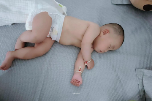 张家口六个月宝宝眼睛散光